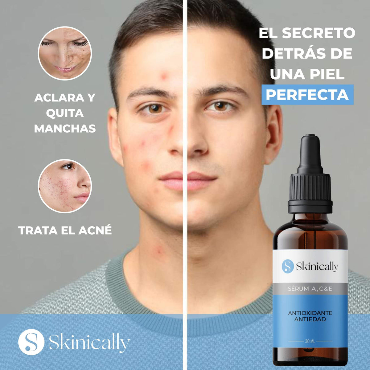 Skinically™️ - Sérum Anti Edad